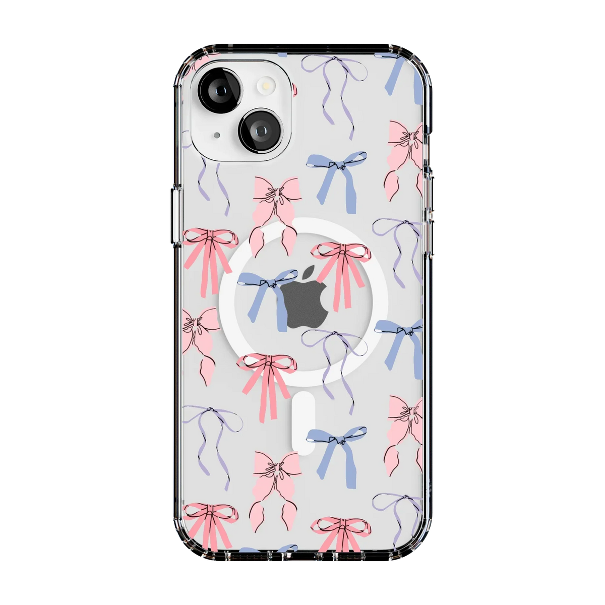 Coquette Girlie | Pastel Bows Case