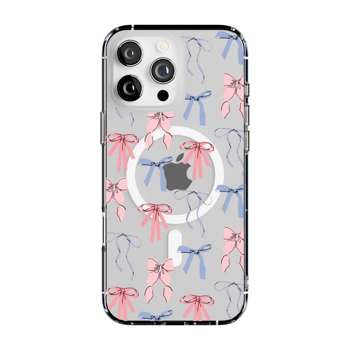 Coquette Girlie | Pastel Bows Case