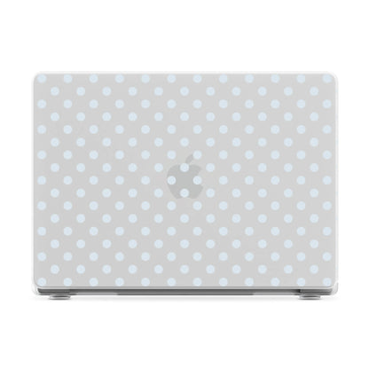 Spotted in SoHo | Light Blue Clear Polka Dot Laptop Shell