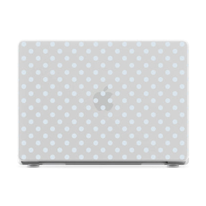 Spotted in SoHo | Light Blue Clear Polka Dot Laptop Shell